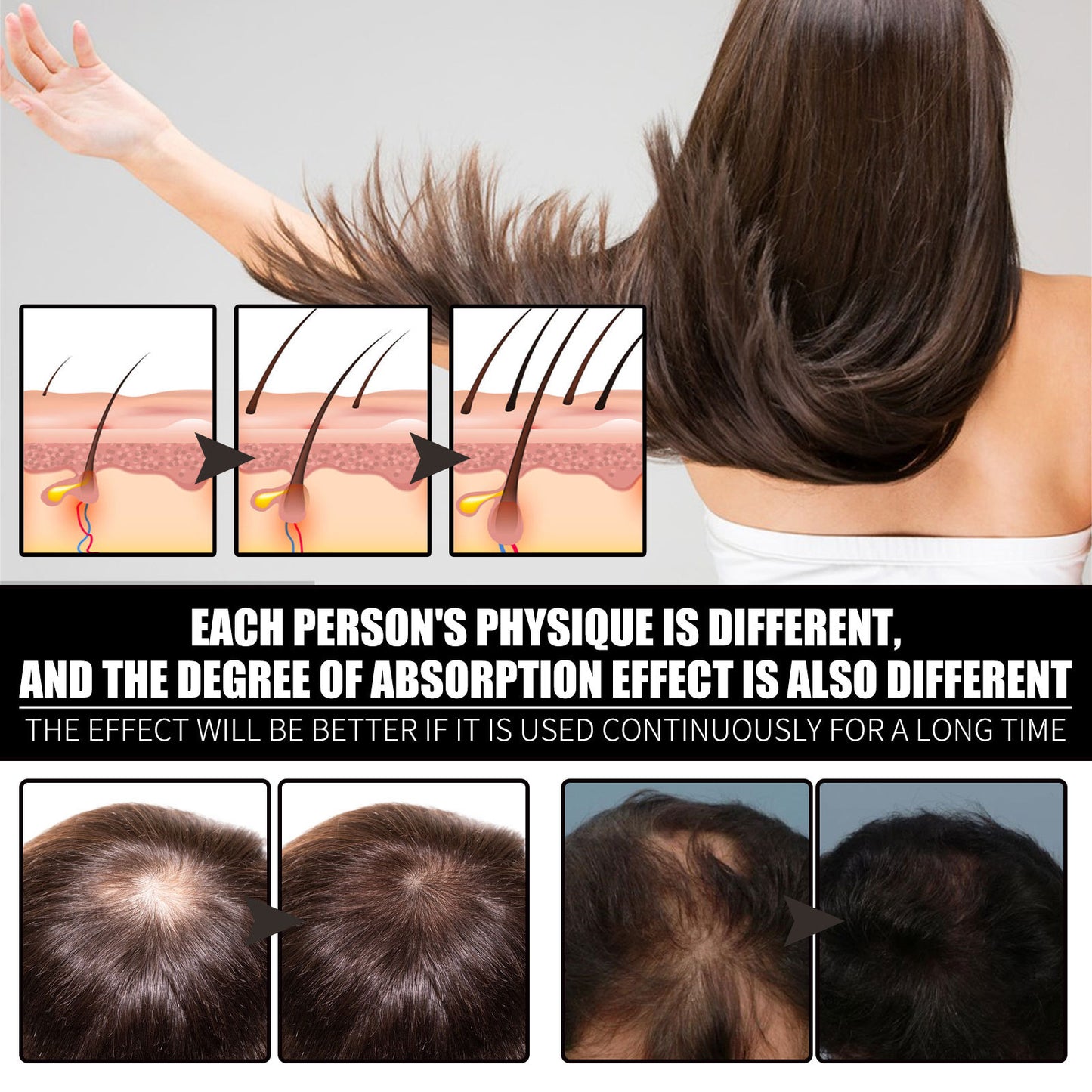 Biotin And Liquid Collagen Supplement For Men & Women