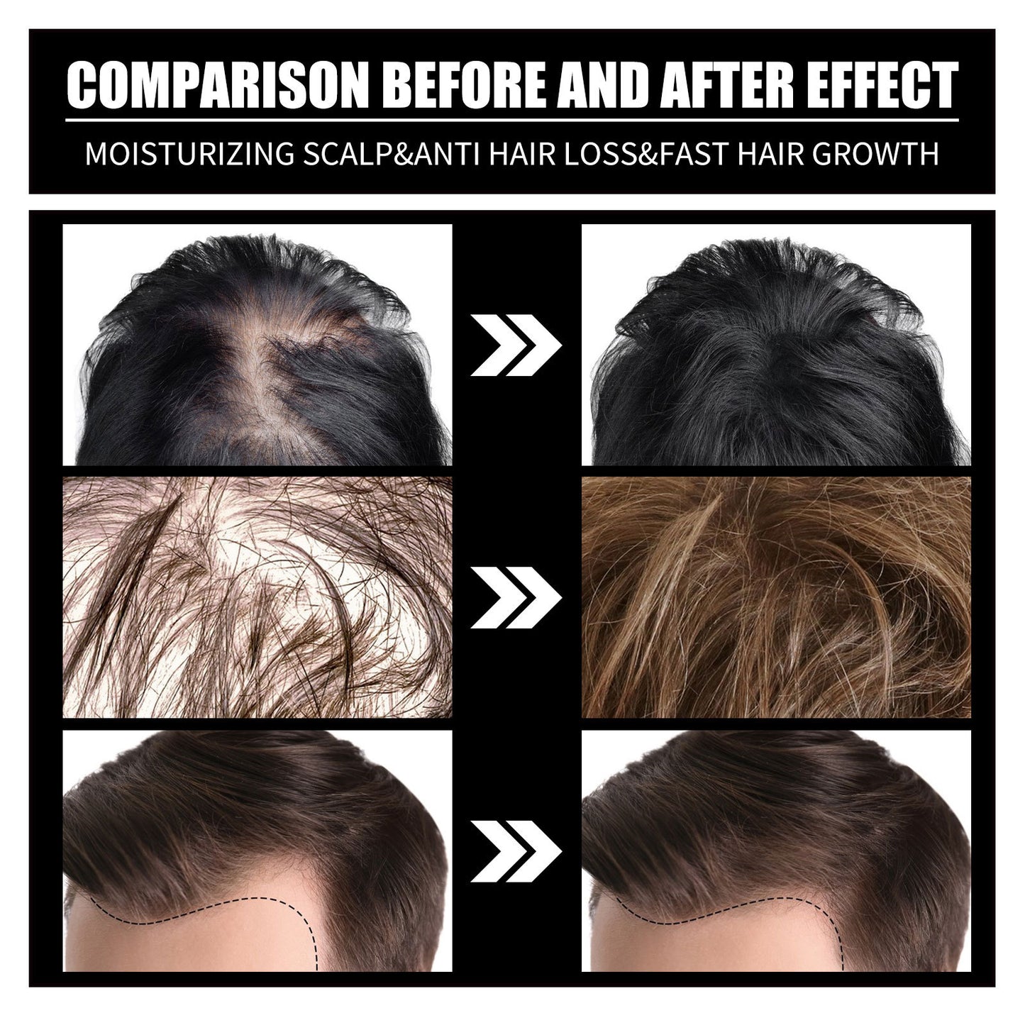 Biotin And Liquid Collagen Supplement For Men & Women