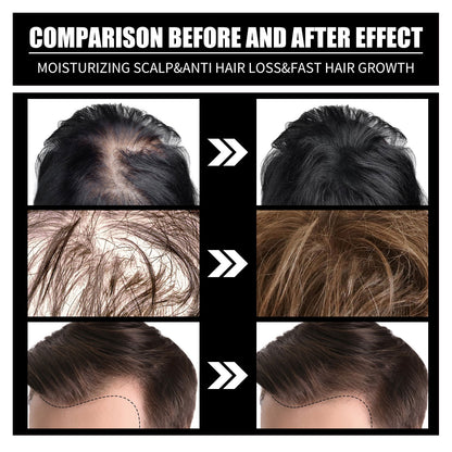 Biotin And Liquid Collagen Supplement For Men & Women